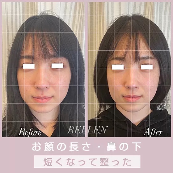 施術例の写真