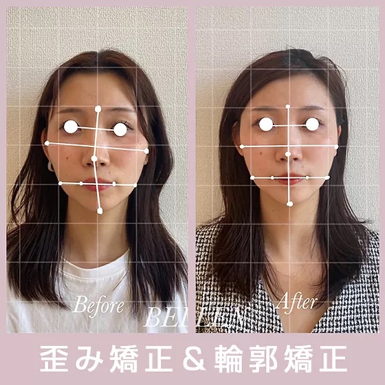 施術例の写真